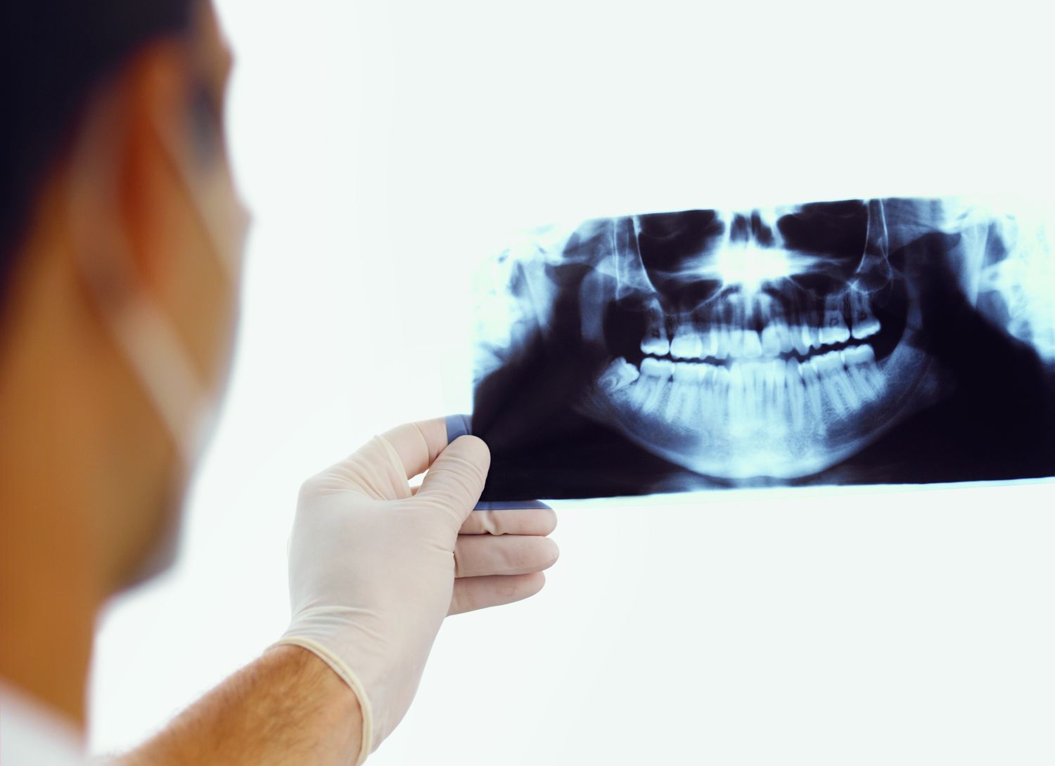 Зеркала внутриротовые для фотографии в стоматологии