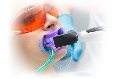 Отбеливание зубов в стоматологической клинике